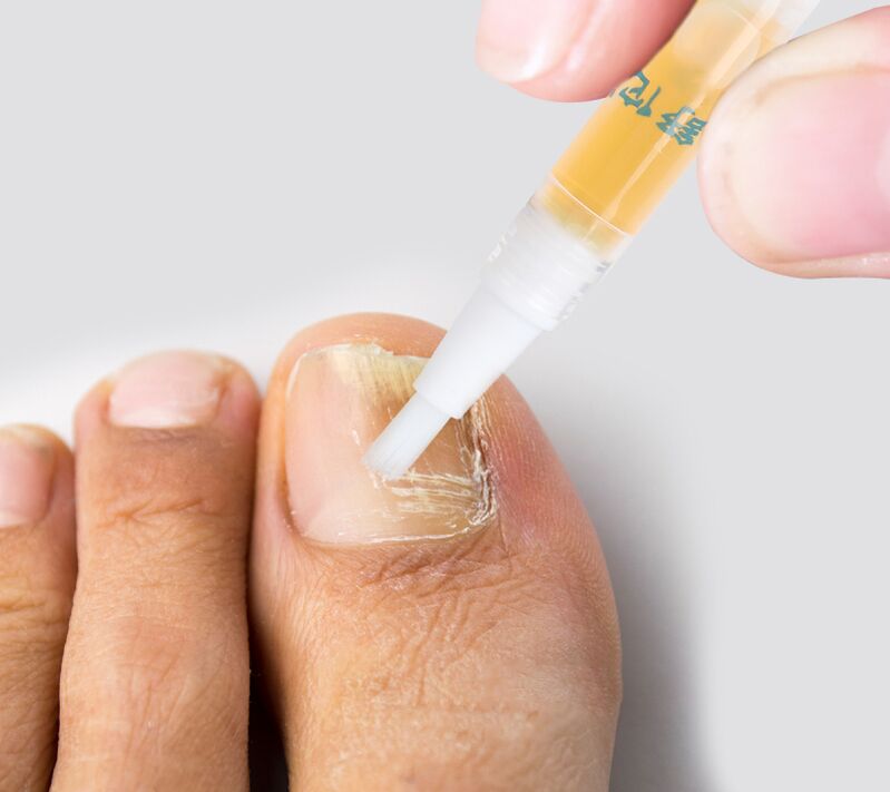 fluid against toenail fungus