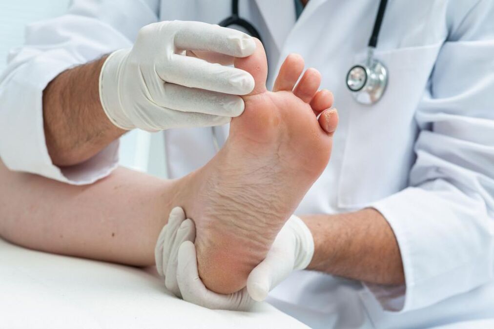 The doctor performs a diagnostic examination on the foot affected by the fungus