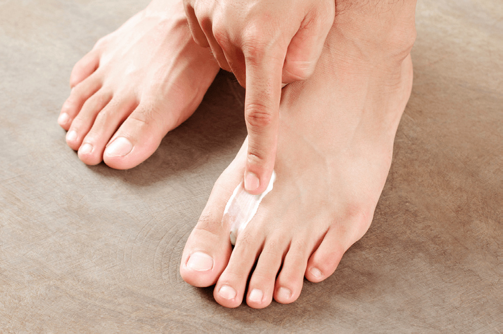 treat fungus between the toes with ointment