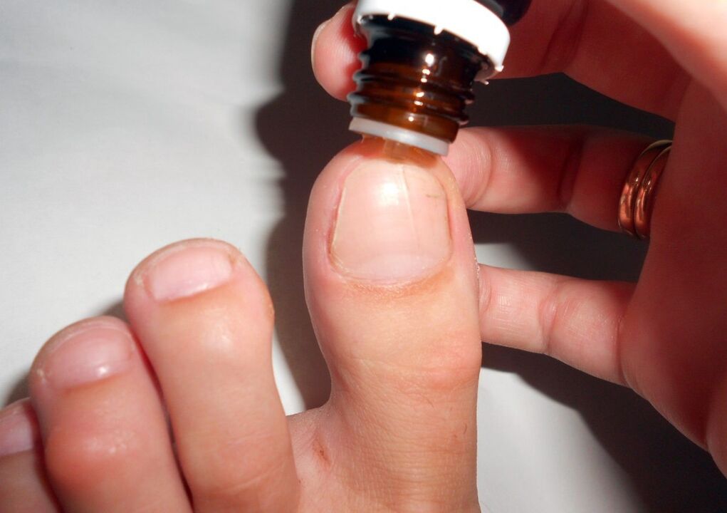 the use of drops for the treatment of nail fungus